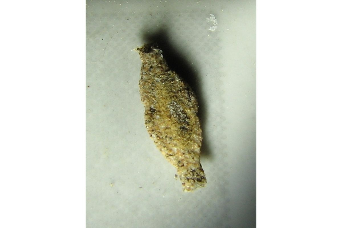 Cara Mengatasi Iritasi Kulit Akibat Bulu Kamitetep: Tips dari Dosen Biologi Universitas Indonesia